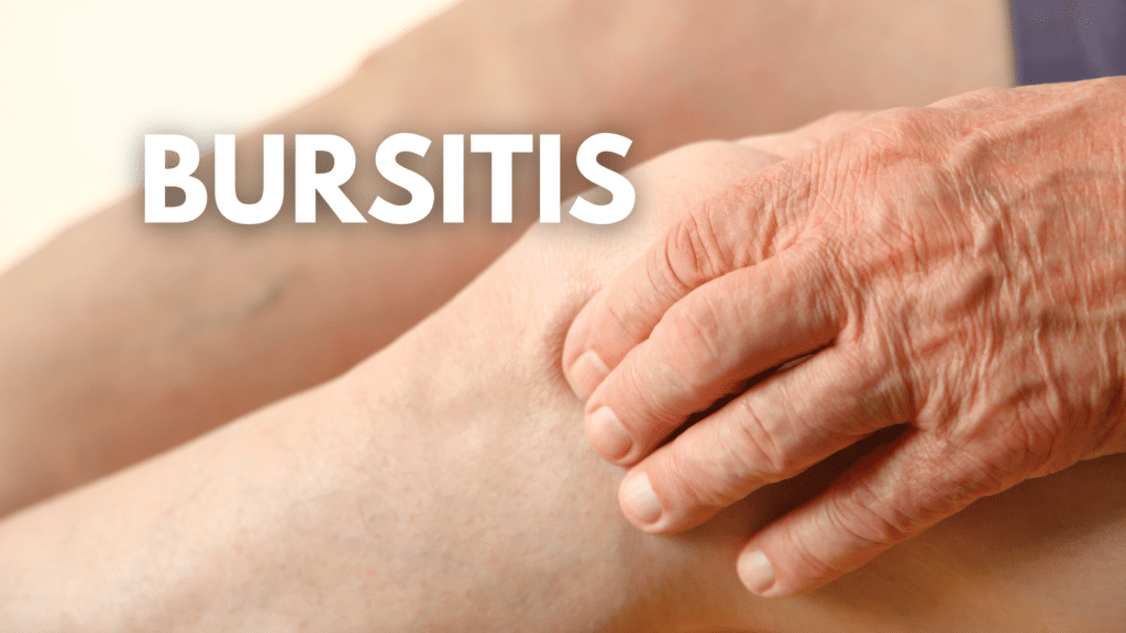 BURSITIS DE LA RODILLA