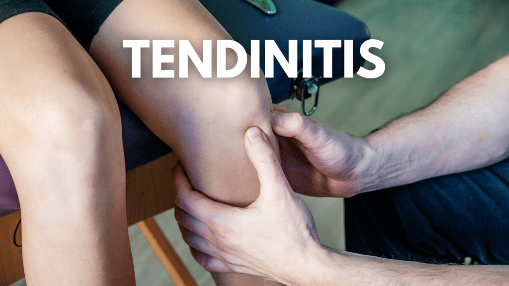 tendinitis rotuliana